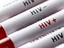 شناسایی گونه جدید HIV در هلند